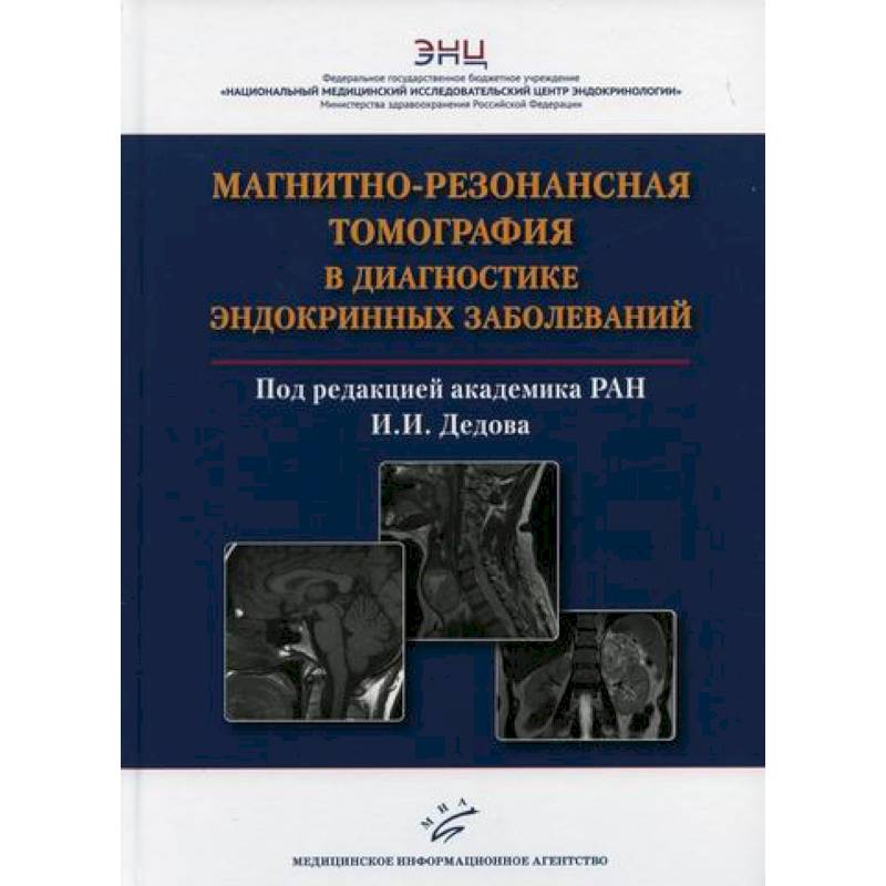 Магнитно-резонансная томография в диагностике эндокринных заболеваний Магнитно-резонансная томография в диагностике эндокринных заболеваний