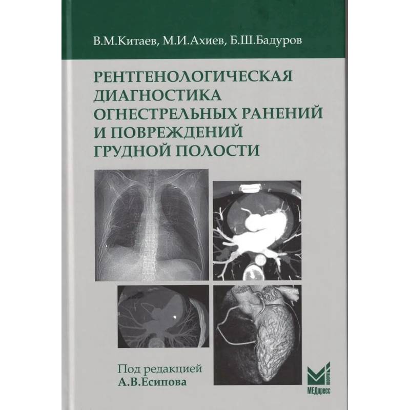 Рентгенологическая диагностика огнестрельных ранений и повреждений грудной полости Рентгенологическая диагностика огнестрельных ранений и повреждений грудной полости