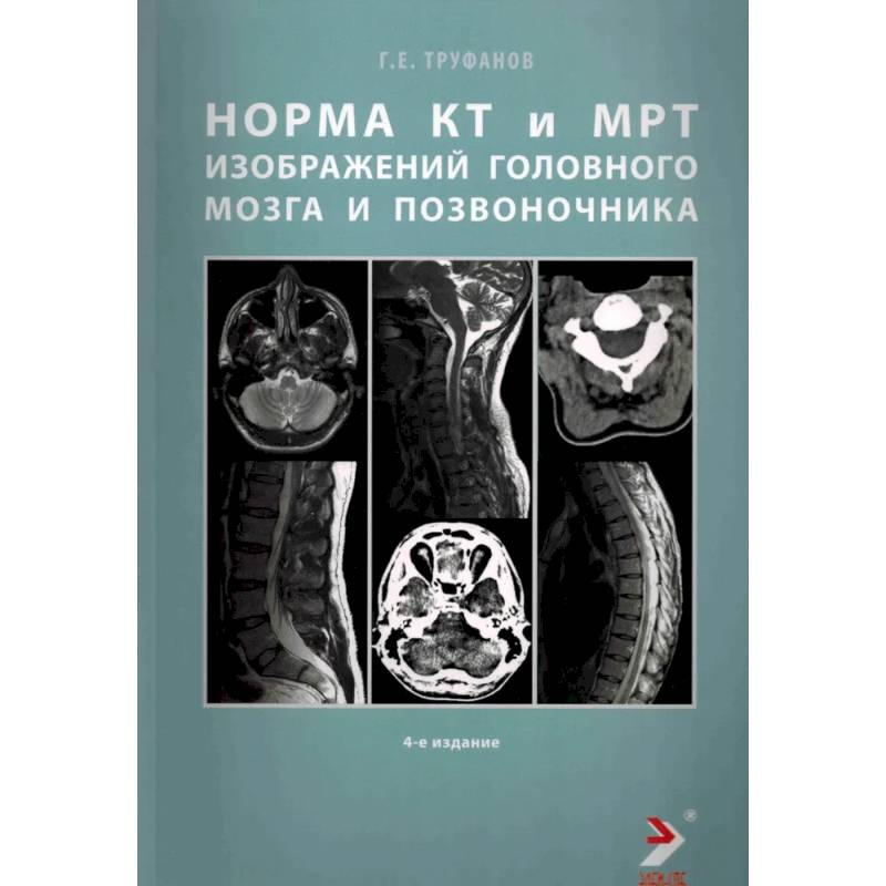 Норма КТ-и МРТ-изображений головного мозга и позвоночника Норма КТ-и МРТ-изображений головного мозга и позвоночника