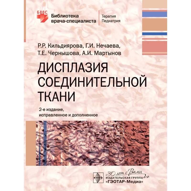 Дисплазия соединительной ткани Дисплазия соединительной ткани