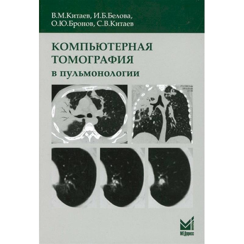 Компьютерная томография в пульмонологии Компьютерная томография в пульмонологии