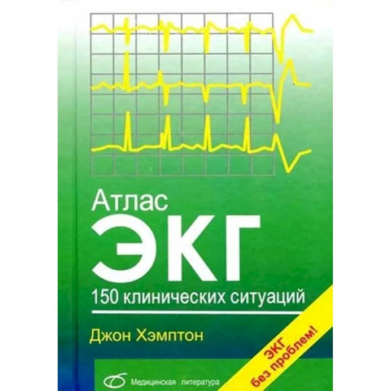 Атлас ЭКГ: 150 клинических ситуаций Атлас ЭКГ: 150 клинических ситуаций