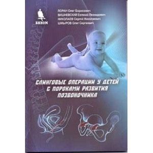 Слинговые операции у детей с пороками развития Слинговые операции у детей с пороками развития