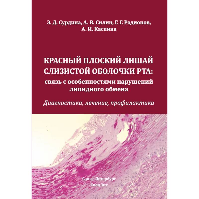 Красный плоский лишай слизистой оболочки рта: связь с особенностями нарушений липидного обмена. Диагностика, лечение, профилактика Красный плоский лишай слизистой оболочки рта: связь с особенностями нарушений липидного обмена. Диагностика, лечение, профилактика