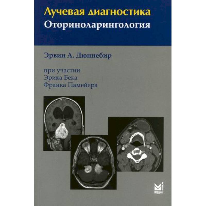 Лучевая диагностика. Оториноларингология Лучевая диагностика. Оториноларингология