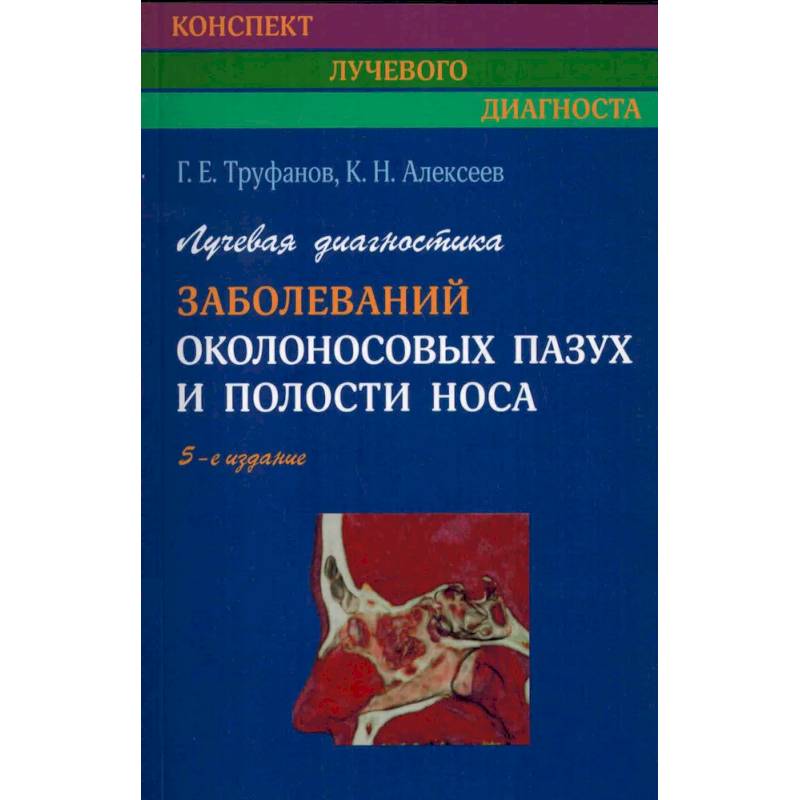 Лучевая диагностика заболеваний околоносовых пазух и полости носа. Лучевая диагностика заболеваний околоносовых пазух и полости носа.