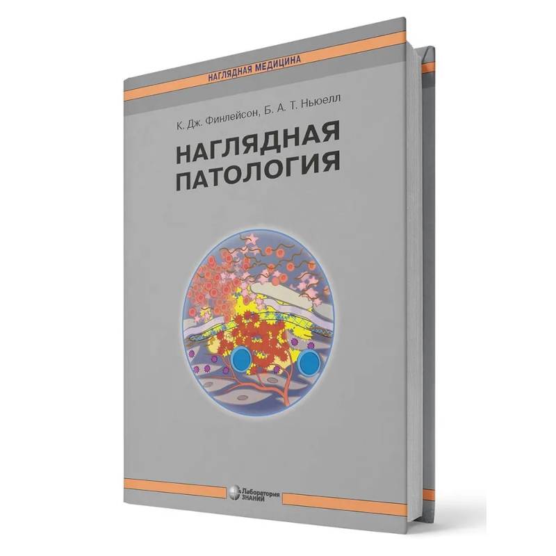 Наглядная патология Наглядная патология