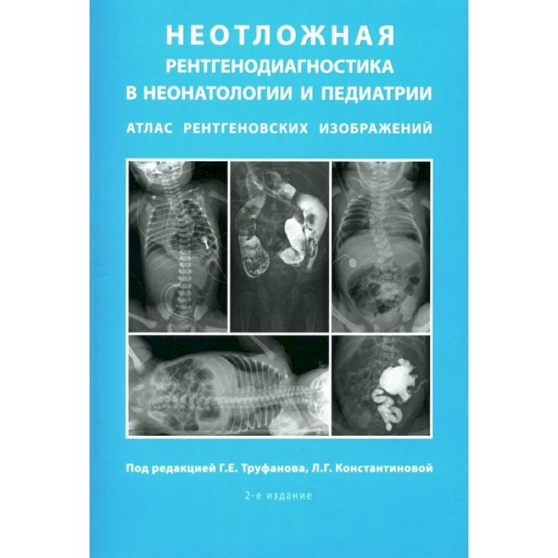 Неотложная рентгенодиагностика в неонатологии и педиатрии. Атлас рентгеновских изображений. Учебное пособие Неотложная рентгенодиагностика в неонатологии и педиатрии. Атлас рентгеновских изображений. Учебное пособие