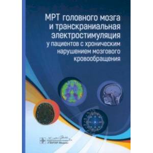 МРТ головного мозга и транскраниальная электростимуляция у пациентов с хроническим нарушением МРТ головного мозга и транскраниальная электростимуляция у пациентов с хроническим нарушением