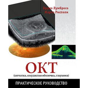 ОКТ сетчатка, сосудистая оболочка, глаукома. Практическое руководство ОКТ сетчатка, сосудистая оболочка, глаукома. Практическое руководство
