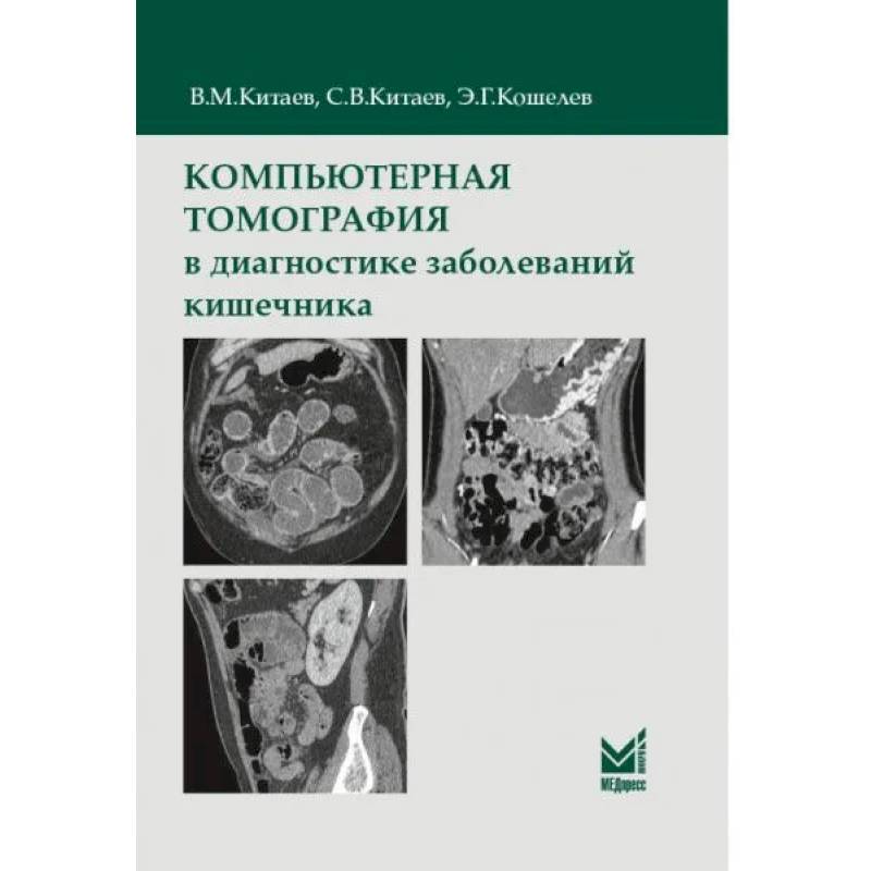 Компьютерная томография в диагностике заболеваний кишечника Компьютерная томография в диагностике заболеваний кишечника