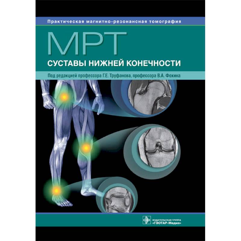 МРТ. Суставы нижней конечности МРТ. Суставы нижней конечности