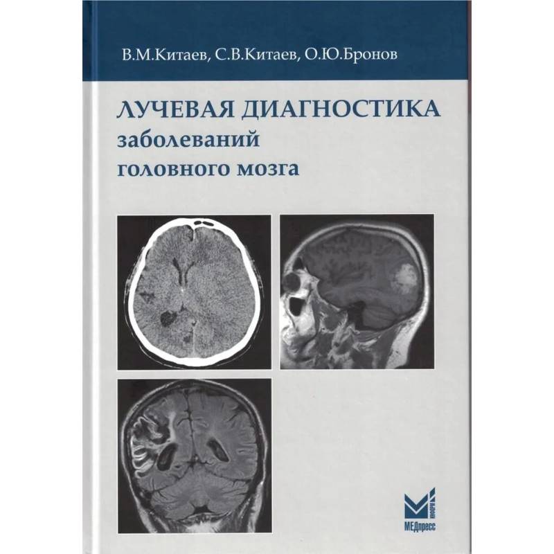 Лучевая диагностика заболеваний головного мозга Лучевая диагностика заболеваний головного мозга