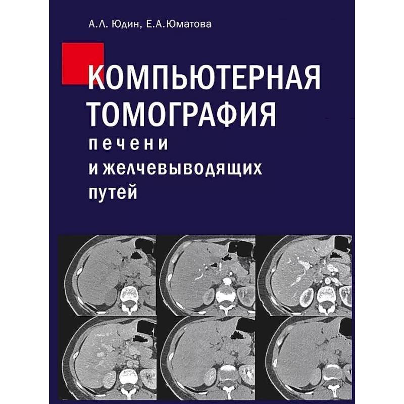Компьютерная томография печени и желчевыводящих путей: практическое руководство Компьютерная томография печени и желчевыводящих путей: практическое руководство