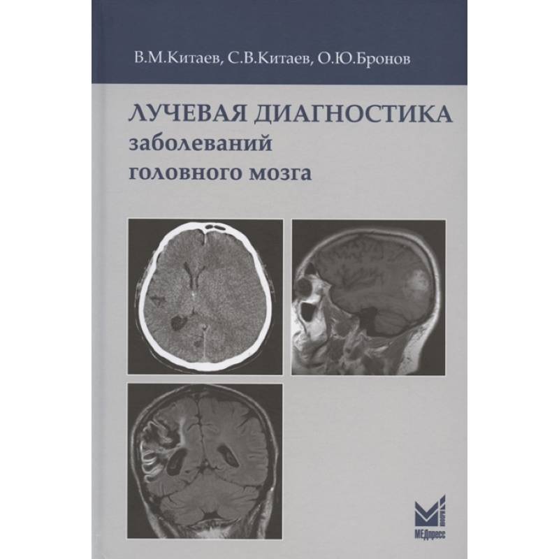 Лучевая диагностика заболеваний головного мозга Лучевая диагностика заболеваний головного мозга