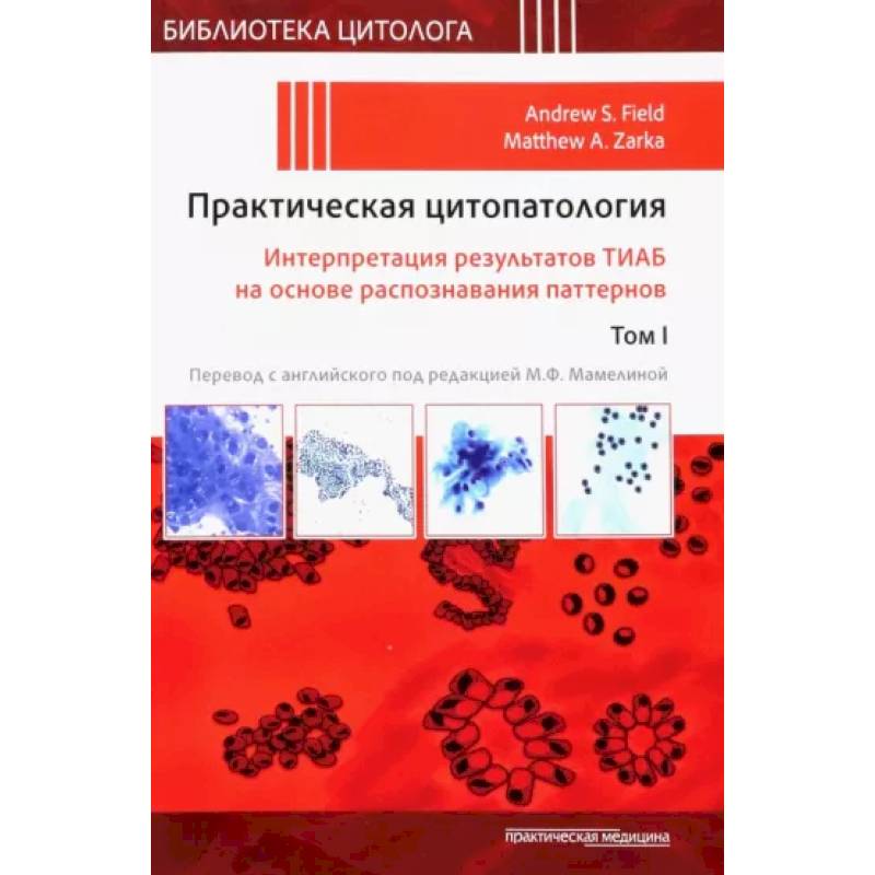 Практическая цитопатология. Интерпретация результатов ТИАБ на основе распознавания паттернов. Том 1 Практическая цитопатология. Интерпретация результатов ТИАБ на основе распознавания паттернов. Том 1