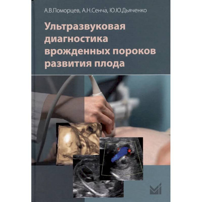 Ультразвуковая диагностика врожденных пороков развития плода Ультразвуковая диагностика врожденных пороков развития плода