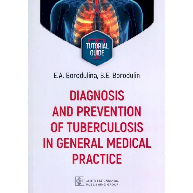 Diagnosis and prevention of tuberculosis in general medical practice: tutorial guide = Диагностика и профилактика туберкулеза в общей врачебной практи Diagnosis and prevention of tuberculosis in general medical practice: tutorial guide = Диагностика и профилактика туберкулеза в общей врачебной практи