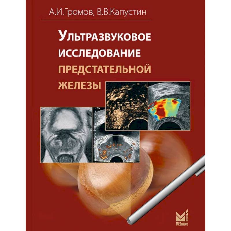 Ультразвуковое исследование предстательной железы Ультразвуковое исследование предстательной железы