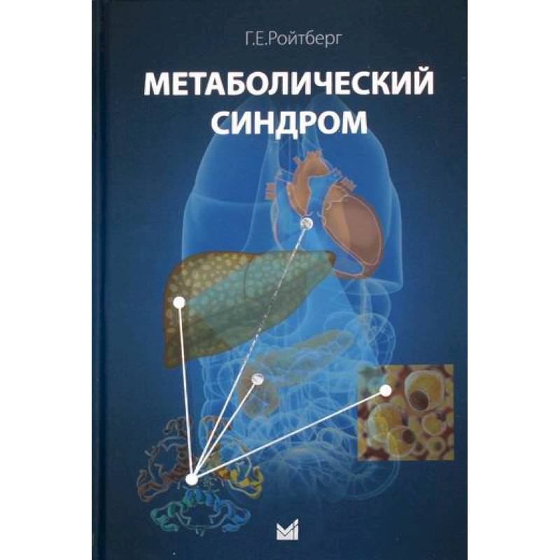 Метаболический синдром Метаболический синдром