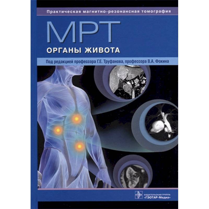 МРТ. Органы живота. Руководство МРТ. Органы живота. Руководство