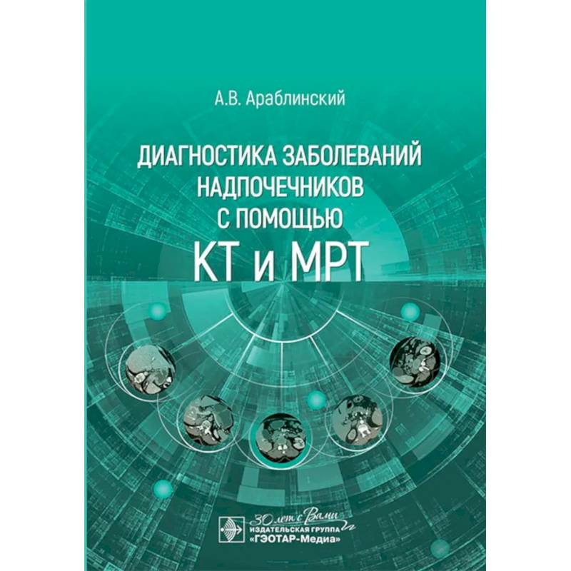Диагностика заболеваний надпочечников с помощью КТ и МРТ Диагностика заболеваний надпочечников с помощью КТ и МРТ