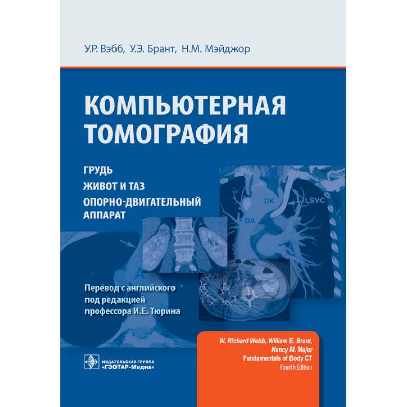 Компьютерная томография. Грудь, живот и таз, опорно-двигательный аппарат Компьютерная томография. Грудь, живот и таз, опорно-двигательный аппарат