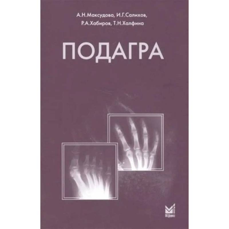 Подагра Подагра