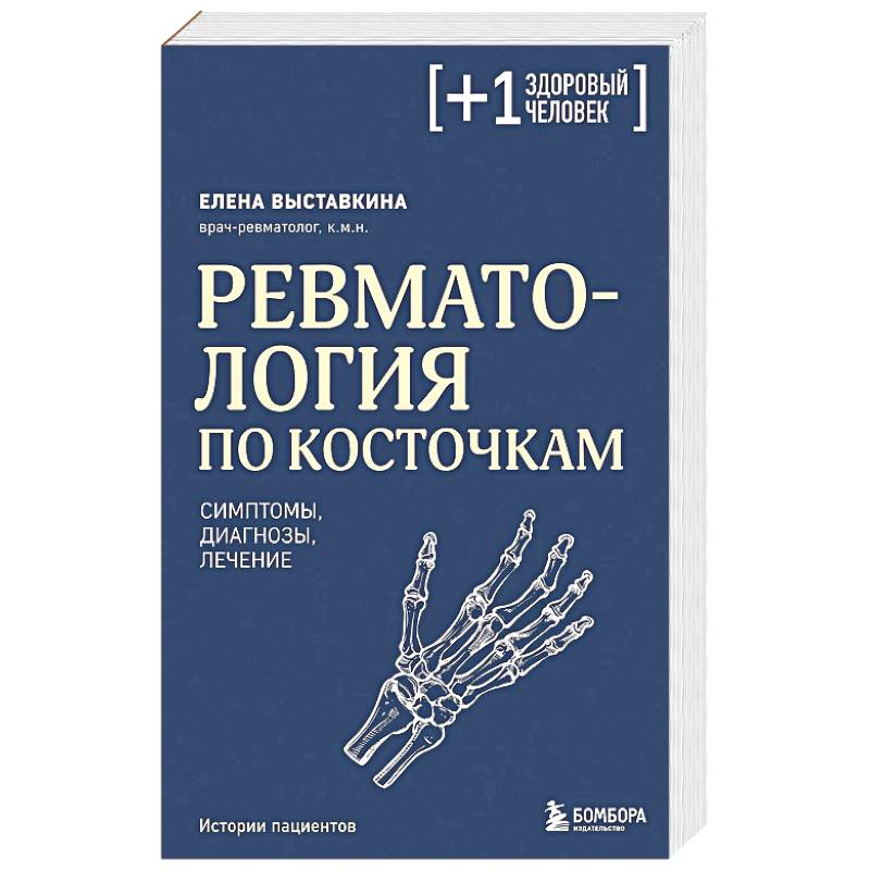 Ревматология по косточкам. Симптомы, диагнозы, лечение Ревматология по косточкам. Симптомы, диагнозы, лечение