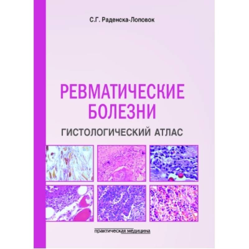 Ревматические болезни. Гистологический атлас Ревматические болезни. Гистологический атлас
