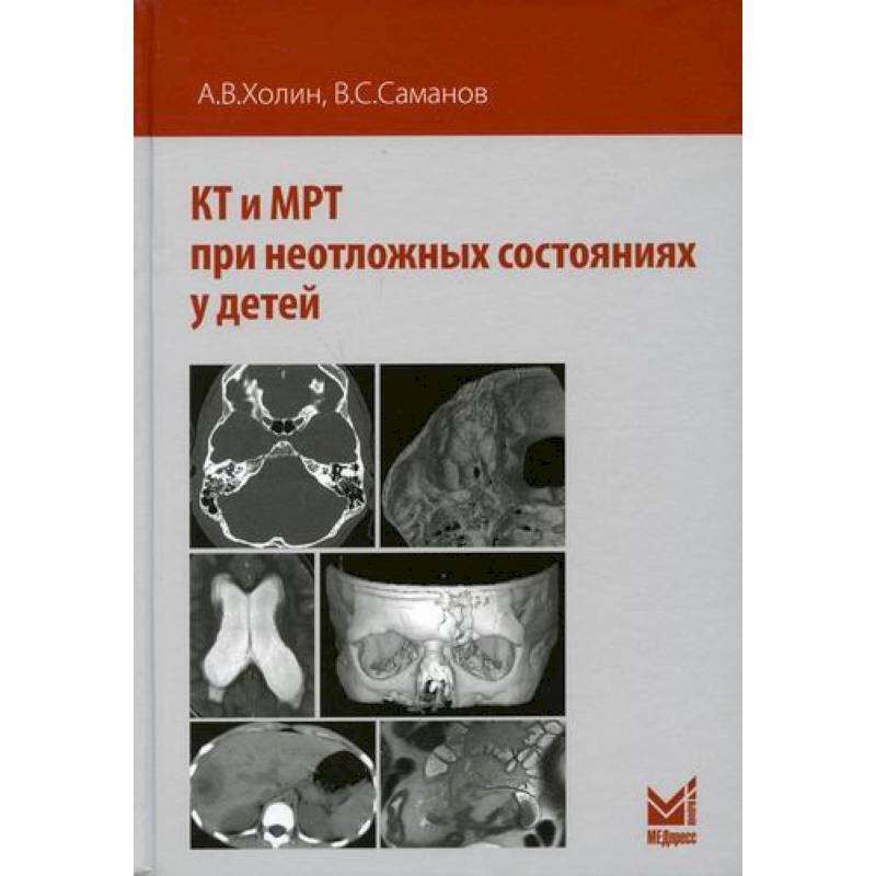 КТ и МРТ при неотложных состояниях у детей КТ и МРТ при неотложных состояниях у детей