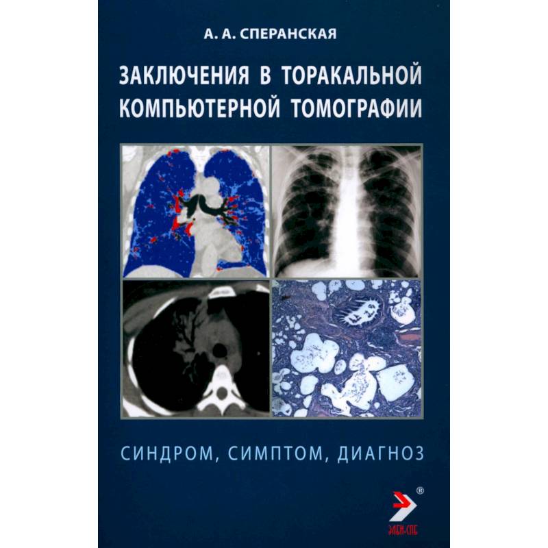 Заключение в таракальной компьютерной  томографии. Симптом, синдром, диагноз. Заключение в таракальной компьютерной  томографии. Симптом, синдром, диагноз.