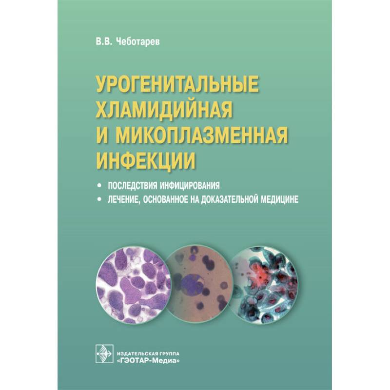 Урогенитальные хламидийная и микоплазменная инфекции. Последствия инфицирвания Урогенитальные хламидийная и микоплазменная инфекции. Последствия инфицирвания