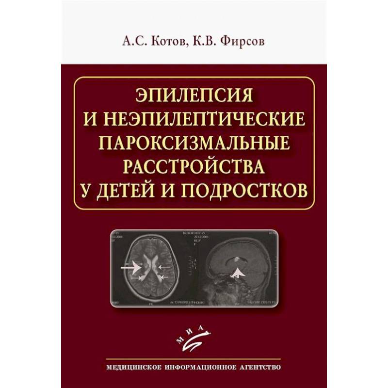 Эпилепсия и неэпилептические пароксизмальные расстройства у детей и подростков Эпилепсия и неэпилептические пароксизмальные расстройства у детей и подростков