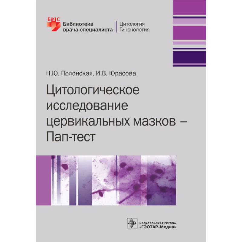 Цитологическое исследование цервикальных мазков Цитологическое исследование цервикальных мазков