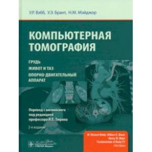 Компьютерная томография. Грудь, живот и таз, опорно-двигательный аппарат Компьютерная томография. Грудь, живот и таз, опорно-двигательный аппарат
