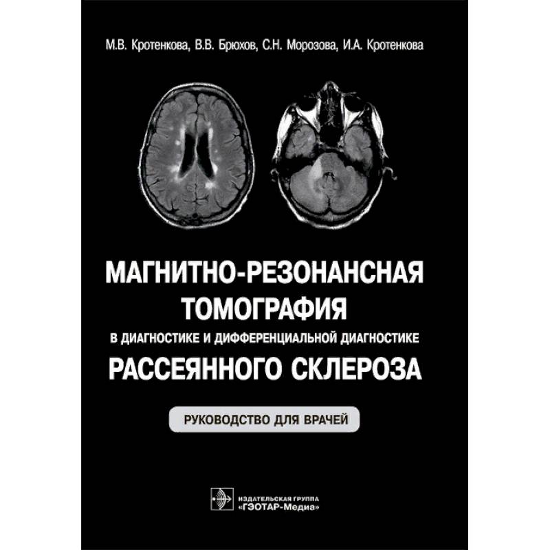 Магнитно-резонансная томография в диагностике и дифференциальной диагностике рассеянного склероза Магнитно-резонансная томография в диагностике и дифференциальной диагностике рассеянного склероза