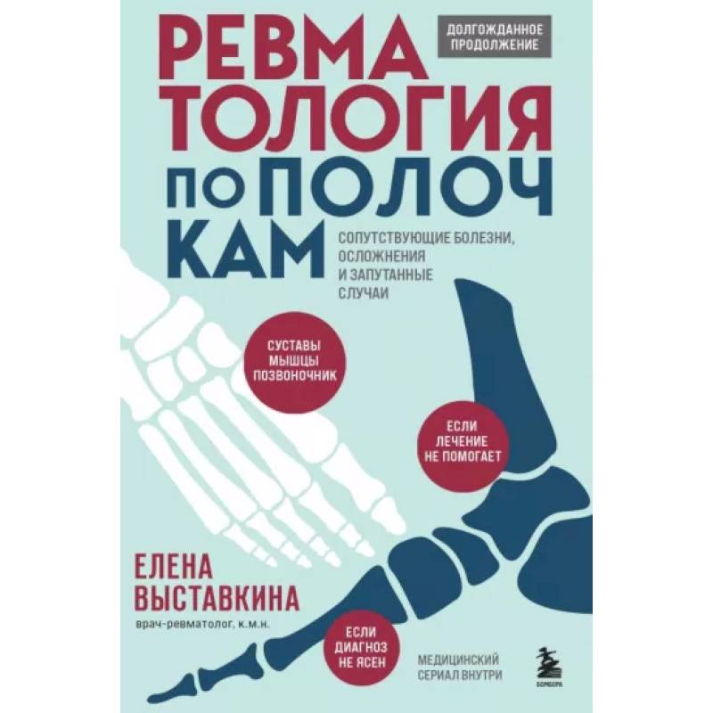 Ревматология по полочкам. Сопутствующие болезни, осложнения и запутанные случаи Ревматология по полочкам. Сопутствующие болезни, осложнения и запутанные случаи