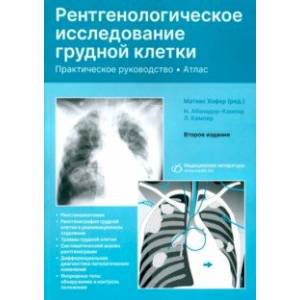 Рентгенологическое исследование грудной клетки. Практическое руководство. Атлас Рентгенологическое исследование грудной клетки. Практическое руководство. Атлас