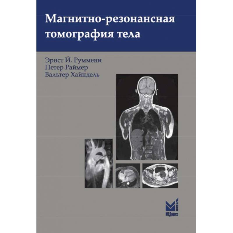 Магнитно-резонансная томография тела Магнитно-резонансная томография тела