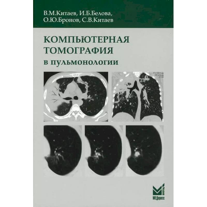 Компьютерная томография в пульмонологии Компьютерная томография в пульмонологии