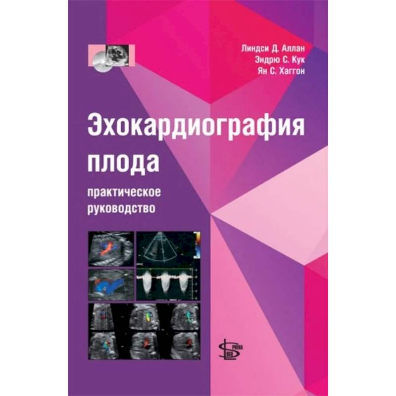 Эхокардиография плода: практическое руководство. + DVD Эхокардиография плода: практическое руководство. + DVD