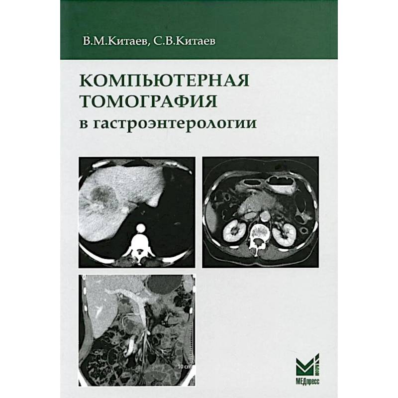 Компьютерная томография в гастроэнтерологии: руководство для врачей. Компьютерная томография в гастроэнтерологии: руководство для врачей.