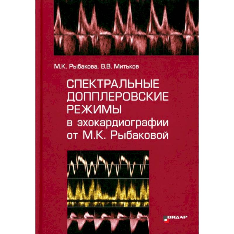Спектральные допплеровские режимы в эхокардиографии от Рыбаковой М.К Спектральные допплеровские режимы в эхокардиографии от Рыбаковой М.К