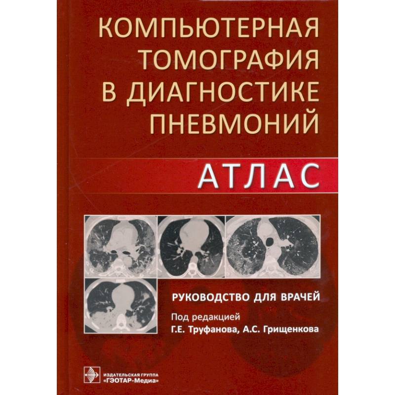 Компьютерная томография в диагностике пневмоний Компьютерная томография в диагностике пневмоний