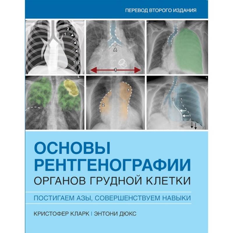 Основы рентгенографии органов грудной клетки Основы рентгенографии органов грудной клетки