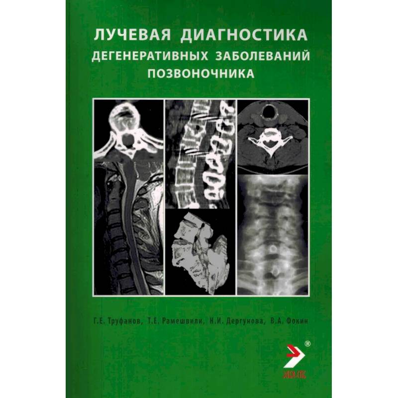 Лучевая диагностика дегенеративных заболеваний позвоночника Лучевая диагностика дегенеративных заболеваний позвоночника