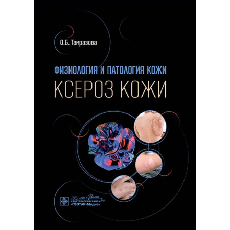Кожные и венерические болезни, книга Физиология и патология кожи. Ксероз кожи купить по скидке