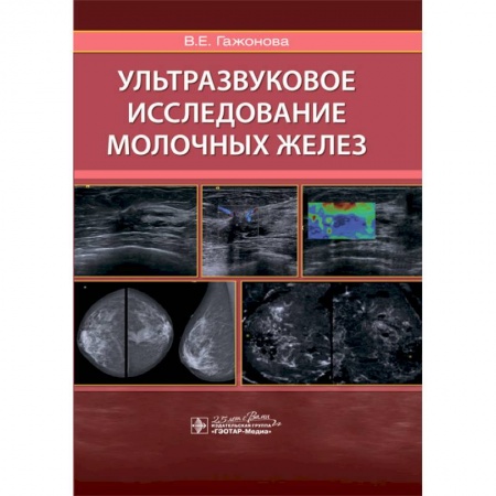 Диагностика и лечение, книга Ультразвуковое исследование молочных желез купить по скидке