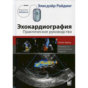 Эхокардиография Эхокардиография